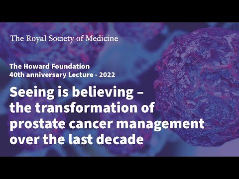 Seeing is believing – the transformation of prostate cancer management by Professor Mark Emberton