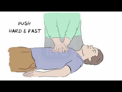 Cardiopulmonary Resuscitation | CPR | IITC