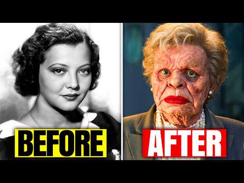 13 Golden Age Stars RUINED by Plastic Surgery. #3 Is SHOCKING!