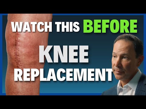 DON'T Get Knee Surgery Until You Watch This! (Doctor’s Honest Breakdown)