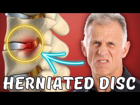 Top 7 Signs You Can Heal Your Own Sciatica/Herniated Disc