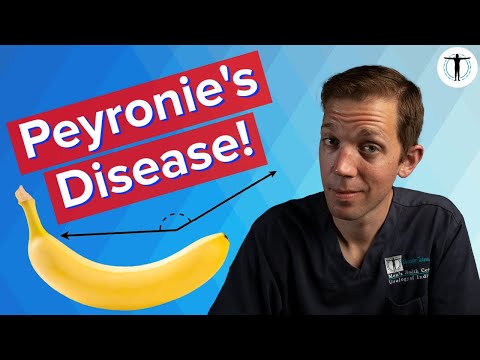 Does Your Penis CURVE?? | Treating Peyronie's Disease!