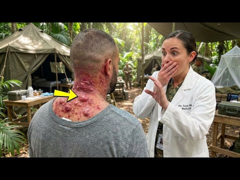 He Thought It Was Just a Mole — What the Doctor Found Changed Everything