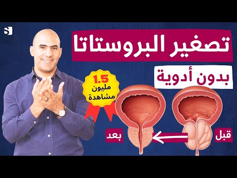 كيفية علاج تضخم البروستاتا وتكرار التبول بأفضل الأعشاب والأطعمة | اهم فيتامين يعيد البروستات للشباب