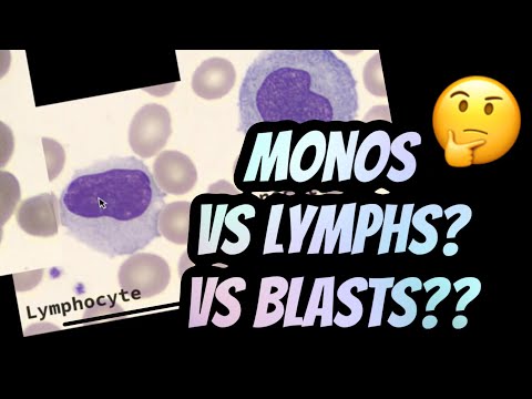 How I distinguish between Lymphocytes vs Monocytes