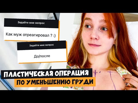 Операция по уменьшению груди: Как отреагировал муж, ДО/ПОСЛЕ, шрамы