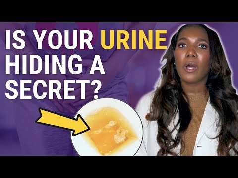 Is Your Urine Silently Screaming Symptoms of Kidney Disease? 5 Alarming Signs