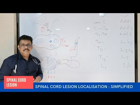 Neurological Localisation in Spinal Lesions || Spinal Lesions Localisation