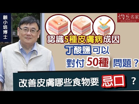 【字幕】顧小培：認識5種皮膚病成因 丁酸鹽可以對付50種問題？改善皮膚哪些食物要忌口？《預防勝於治療》（2022-07-10）