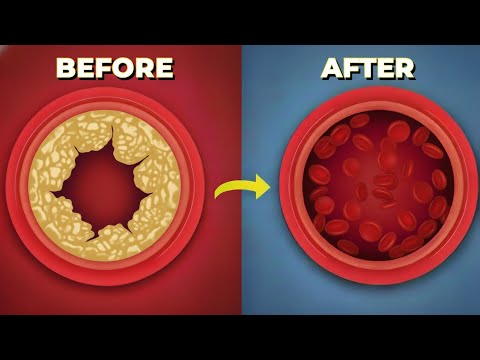 The Best Meal to Clean Your Arteries - Science Says