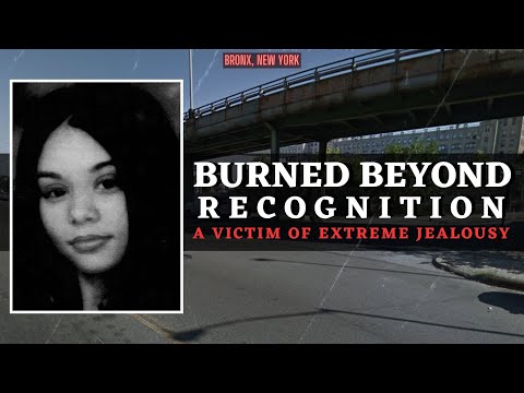 Teen Left Scorched Beyond Recognition - Extreme Jealousy Leads To Horror - Story Of Taisha Camacho