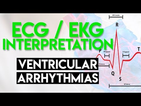 Ventricular Arrhythmias | ECG EKG Interpretation (Part 5)
