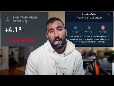 My Wearables Knew I Was Sick Before I Did (Apple, Oura, WHOOP)