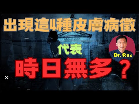 (中英字幕EngSub) 皮膚上出現這四種症狀，代表時日無多？4 skin signs of advanced cancer