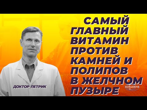 The most important vitamin against gallstones and polyps
