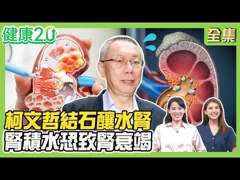 柯文哲腰痛竟輸尿管結石釀水腎！腎積水恐致腎衰竭！狂喝可樂養出35顆結石 檸檬酸防結石！護腎4大營養素！健康2.0 20250920【完整版】#陳欣湄#韋汝#陳俊宇#黃賢祥#吳明珠#許瓊月#雷議宗