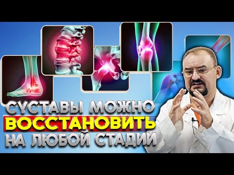 Как вылечить суставы на любой стадии болезни?