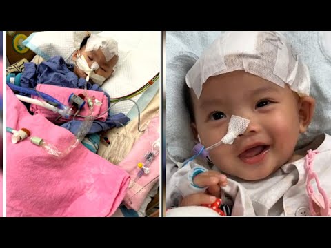 九個月大小雪兒將接受腦部手術  媽媽希望全城集氣祝福女兒渡過難關