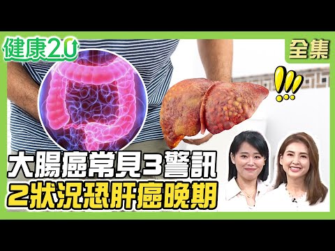 90後恐將癌症年輕化！血便、腹脹、放臭屁是大腸癌警訊！肝癌難發現 疲倦、暴瘦恐已晚期！中醫教清腸養肝秘方！健康2.0 20250531【完整版】#陳欣湄#韋汝#許秉毅#廖婉絨#陳麗華#趙函穎#雷議宗