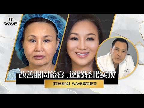 【真实案例】年过58？数次整形失败？但最后还是整成了温碧霞！