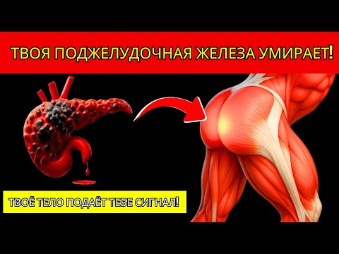 8 Ранних Симптомов Рака Поджелудочной Железы 🚨 Не Игнорируйте Их!