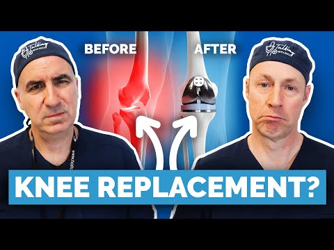 What Actually Happens During a Knee Replacement?  Step By Step
