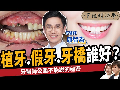 【健康】滿口缺牙怎麼辦？名醫公開植牙、牙橋、假牙不能說的秘密！ft.牙醫師 康智為｜下班經濟學459