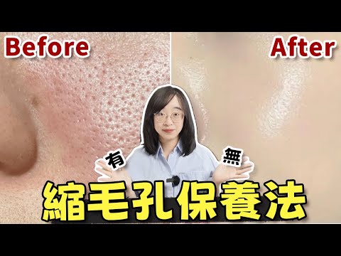 毛孔大怎麼辦！5種毛孔，都有辦法改善！Different Pore Types & How to Care for Them丨配方师刘星丨#毛孔 #毛孔粗大 #毛孔堵塞 #改善毛孔 #黑頭  #黑头