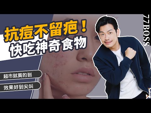 抗痘不留疤?吃「這些」超抗痘,加速痊癒、消除痘印、減少痘疤!【77老大】
