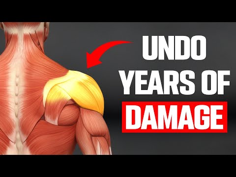 Why Your Shoulders Hurt (And The 5 Movements That Fix It)