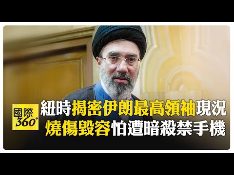 要整容?! 紐時爆料伊朗領袖腿恐怕截肢.待裝義肢 不出聲憂被視為脆弱 【國際360】20260424@全球大視野Global_Vision