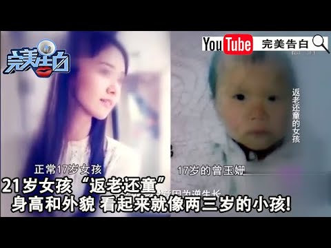 【完美告白】返老还童的女孩:21歲女孩“返老還童”,身高和外貌,看起來就像兩三歲的小孩!