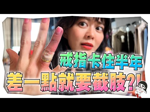 戒指卡到手直接發黑,該不會要截肢了吧...?|白癡公主