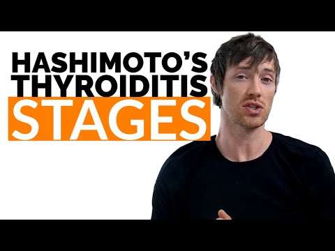 6 Stages of Hashimoto's Thyroiditis That ALL Patients Go Through