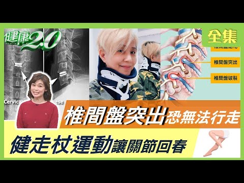 李明依頸椎手術自費110萬! 椎間盤突出壓迫神經恐無法行走! 舌之呼吸、健走杖運動讓關節回春! 健康2.0 20211120 (完整版)