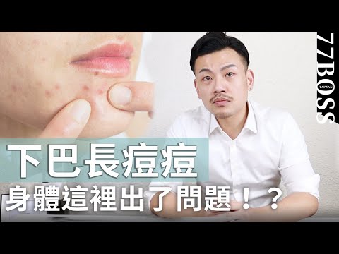 下巴常長痘,居然是這裡有問題!3周改善下巴痘、經前痘,徹底根治改頭換面!【77老大】