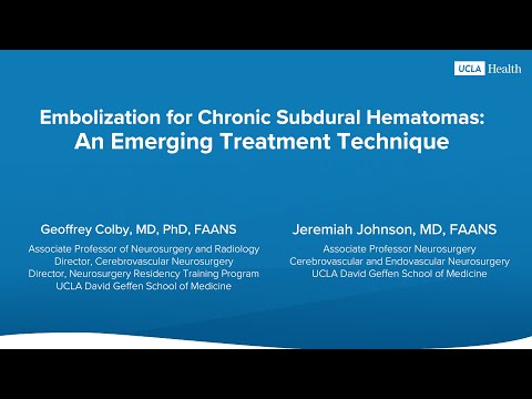 MMA Embolization: An Emerging Treatment Technique for Chronic Subdural Hematomas | UCLA Health