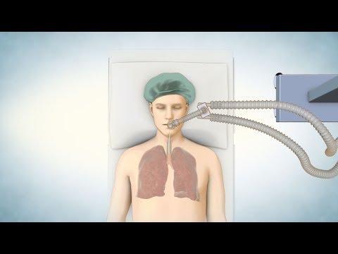 Lung Transplant Process