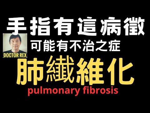 肺部纖維化: 要留意手指這些變化!及早發現才能控制病情! hand signs of lung fibrosis