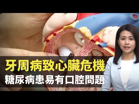 牙周病致心臟危機 糖尿病患易有口腔問題- 最強生命線 - 香港新聞 - TVB News- 黃靖婷