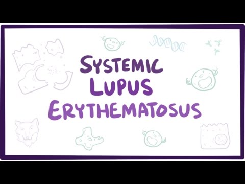 Systemic lupus erythematosus (SLE) - causes, symptoms, diagnosis & pathology