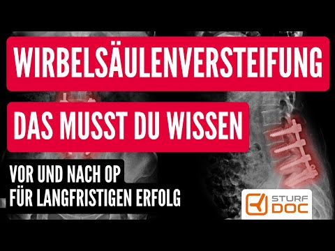 Versteifungsoperation der Lendenwirbelsäule - Das MUSST Du vor und nach der Operation wissen!