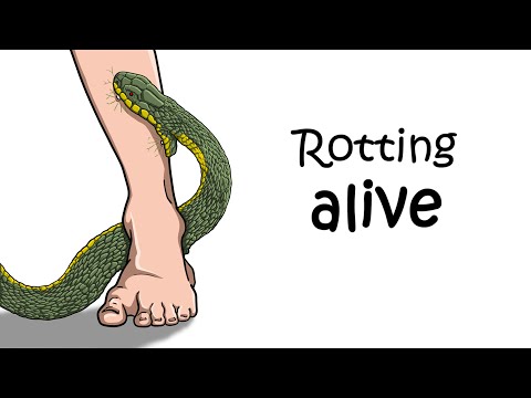 What It Feels Like to Die From a Snake Bite