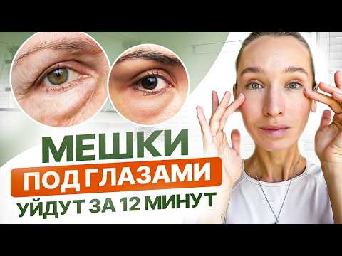 Отёки и мешки под глазами, малярные мешки, нависшее веко и грыжи | Делай ЭТИ 5 упражнений