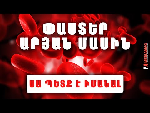 ԱՐՅՈՒՆ. Կյանքի հեղուկ։ Հետաքրքիր փաստեր։ Դուք սա պետք է իմանաք