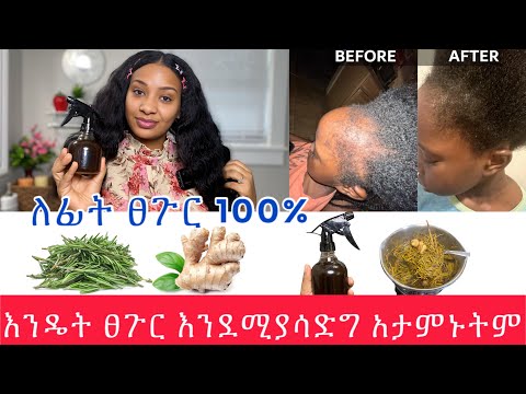 ⭐️ከፀጉር ማሳደግያ መድሀኒቱ minoxidil እኩል ይሰራል በየቀኑ ተጠቀሙት// best hair loss, hair growth homemade remedy