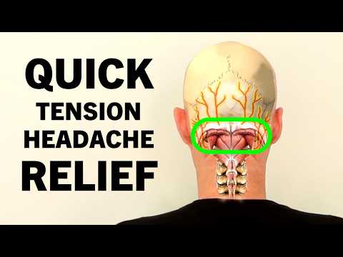 Tension Headache Exercises. Stress Headache Relief in 4 Minutes.