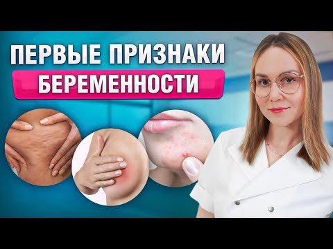 Как узнать о беременности ДО ЗАДЕРЖКИ? Ранние симптомы беременности