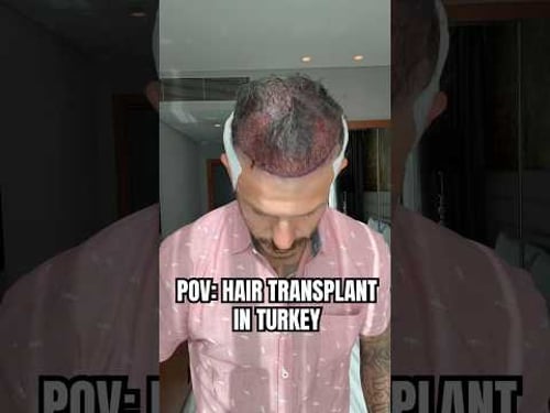 Let’s go to turkey to get a hair transplant.