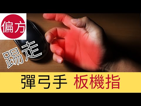 彈弓手|板機指自然療法